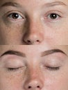 Eyebrows before after Royalty Free Stock Photo