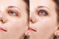 Eyelash Extension Procedure. Comparison of female eyes before and after. Royalty Free Stock Photo
