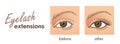 Eyelash extensions. Before and after vector illustration