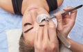 Eyelash removal procedure close up.