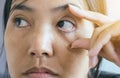 Eyelid layer,Veins on red eye asian woman,Causes the use of eyes and not enough rest Royalty Free Stock Photo