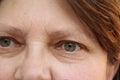Eyes of an elderly woman with wrinkles on the eyelids, part of the face close-up, overhang, the concept of age-related changes in Royalty Free Stock Photo