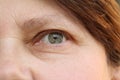 Eyes of an elderly woman with wrinkles on the eyelids, part of the face close-up, overhang, the concept of age-related changes in Royalty Free Stock Photo