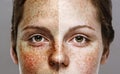 Eyes Woman freckle happy young beautiful studio portrait with healthy skin half Royalty Free Stock Photo