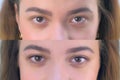 Eyes Of Young Girl Before And After Beauty Procedure Of Permanent Eyeliner.