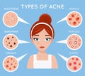 Face acne women skin cosmetic care pimple problem beauty cosmetics medicine beautiful girl head design vector