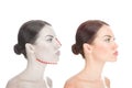 Woman in profile with Before and after mentoplasty and rhinoplasty Royalty Free Stock Photo