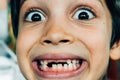 Face of boy smiling with missing teeth Royalty Free Stock Photo