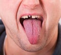 Face with broken tooth and tongue Royalty Free Stock Photo