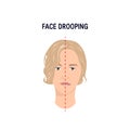 Face drooping concept