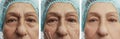 Face of an elderly woman with wrinkles contrast removal on the face before and after procedures, arrow Royalty Free Stock Photo
