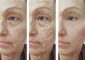 Face, elderly woman, wrinkles, health plastic filler patient contrast correction before and after procedures, arrow Royalty Free Stock Photo