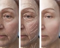 Face, elderly woman, wrinkles, cosmetology correction before and after procedures, arrow Royalty Free Stock Photo