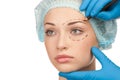 Face before plastic surgery operation Royalty Free Stock Photo