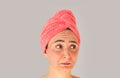 Face with skin irritation, problems, acne, rash or sunburn Royalty Free Stock Photo