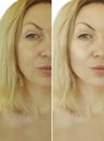 Face woman wrinkles before and after Royalty Free Stock Photo