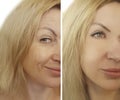 Face woman wrinkles before and after Royalty Free Stock Photo