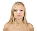 Face of young woman with sticking plaster on nose Royalty Free Stock Photo