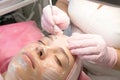 Facial cleansing from comedones in a beauty salon. Acne in teenagers.