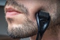 Facial hair care concept. Young man is using derma roller on beard.