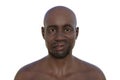 Facial palsy in an African man, 3D illustration highlighting the asymmetry and drooping of the facial muscles on one side of the