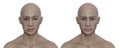 Facial palsy in a man and the same healthy man, 3D illustration showing the asymmetry and drooping of the facial muscles on one