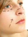 Facial plastic surgery Royalty Free Stock Photo