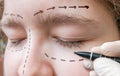 Facial plastic surgery. Hand is drawing lines with marker around eye Royalty Free Stock Photo