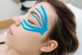 Facial tape, close-up of a girl`s face with an anti-wrinkle cosmetology tape. Aesthetic taping of the face