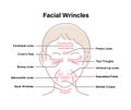 Facial wrinkles  female face  vector illustration Royalty Free Stock Photo