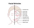 Facial wrinkles  female face  vector illustration Royalty Free Stock Photo