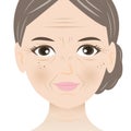 Facial wrinkles woman vector illustration isolated on white background.