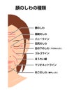 Facial wrinkles ( female face ) vector illustration / Japanese Royalty Free Stock Photo