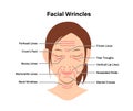 Facial wrinkles ( female face ) vector illustration Royalty Free Stock Photo
