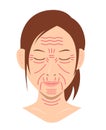 Facial wrinkles ( female face ) vector illustration / no text Royalty Free Stock Photo