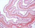 Fallopian tube. Ciliated epithelium