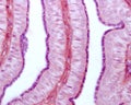 Fallopian tube. Ciliated epithelium