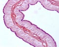 Fallopian tube. Ciliated epithelium