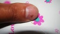 A false scorpion on my finger