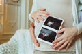 Family planning. Loving husband hugging his pregnant wife holding ultrasound scan in hands Royalty Free Stock Photo