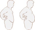 Fat belly before and after treatment