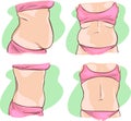 Fat belly before and after treatment.