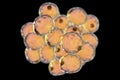 Fat cells, or adipose cells Royalty Free Stock Photo