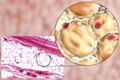 Fat cells, micrograph and 3D illustration