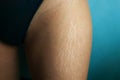 Fat Cellulite And Stretch Mark On Tan Skin Woman Leg At Home, Women Diet Styl Royalty Free Stock Photo