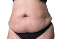 Fat female belly after pregnancy, stretch marks closeup Royalty Free Stock Photo