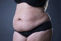 Fat female belly, stretch marks closeup Royalty Free Stock Photo