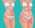 Fat girl. Loss weight on diet or sport. Before picture. Weight loss concept. Royalty Free Stock Photo