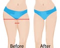 Fat and slim girls` hips. Before and after.