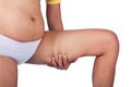 Fat thighs, cellulite Royalty Free Stock Photo